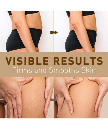 Bee Venom Ginger Body Oil Bee Venom Belly Button Drops Bee Venom Drops Skin Firming Body Cream Ginger Essential Oil Belly Drainage Ginger Oil Bee Venom Tightening Skincare and Shaping Body Curve - Buy Online on GoSupps.com