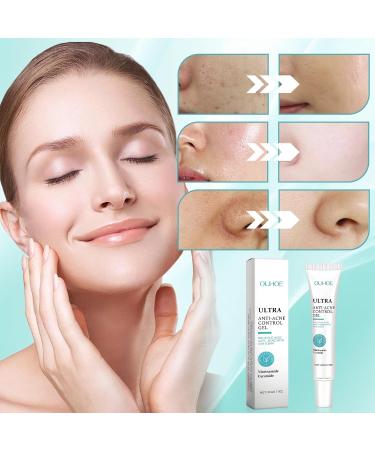 Henjunu Pimple cream antipimple gel acne cream gentle and nonirritating reduces blackheads and acne improves the appearance of the skin 20 g - Buy Online on GoSupps.com