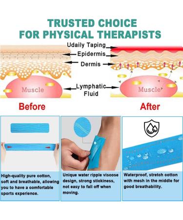 ATETEO Kinesiology Tape - Dark Green - Large Size - 5m x 5cm - Buy Online on GoSupps.com