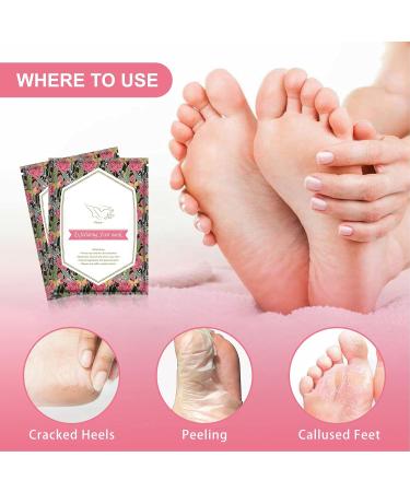 5 Pack Foot Peeling Mask - Exfoliating Rose Foot Scrub for Soft Smooth Feet | Dead Skin Remover for Men & Women - International Shipping - Buy Online on GoSupps.com