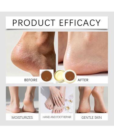 Moisturizing Hand Cream - Callus Balm with Anti-Cough Protection | Foot Moisturizer - for Young People the Elderly Fingers Elbows Autumn Winter - Buy Online on GoSupps.com