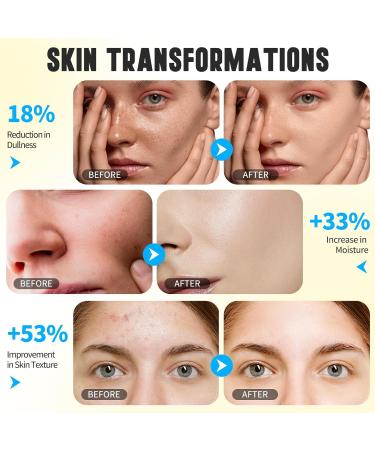 Turmeric Kojic Acid Facial Cleanser Exfoliating Mousse Cleansing Fight Acne Balance Skin Oil And Water Lighten Blemishes Brightens Skin Tone Safe For Sensitive Skin 150Ml - Buy Online on GoSupps.com