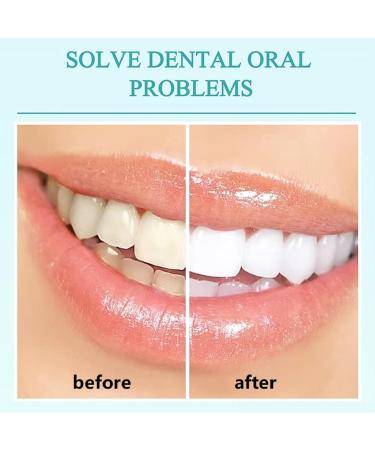 Bright Whitening Teeth Mousse - Deep Clean Repair & Refresh | International Shipping - Buy Online on GoSupps.com