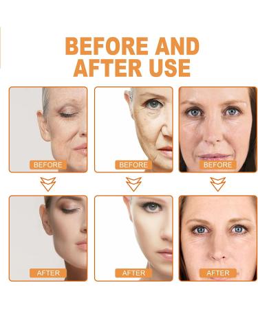 KOAHDE Anti Aging Soft Face Cream Wild Yam Moisturizing Face Cream Moisturizing Anti Wrinkle Cream Wild Yam Collagen Moisturizing Cream Wild Yam Whitening Moisturizing Cream Wild Yam Anti Aging Cream - Buy Online on GoSupps.com