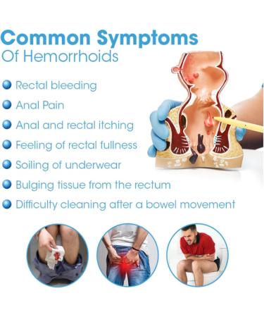 Natural Herbal Strength Hemorrhoid Capsules Hemorrhoid Treatment for Women Men Helps Relieve Itching Burning Haemorrhoid Treatment & Piles Treatment Suppositories (2Box) - Buy Online on GoSupps.com