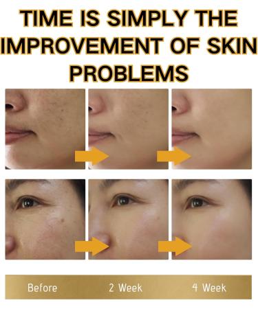 Brightening Repair Face Cream - Face Cream for Women - Face Moisturiser for Dark Spot Correcting - Moisturizing and Anti-Blemish Spot Cream - Buy Online on GoSupps.com