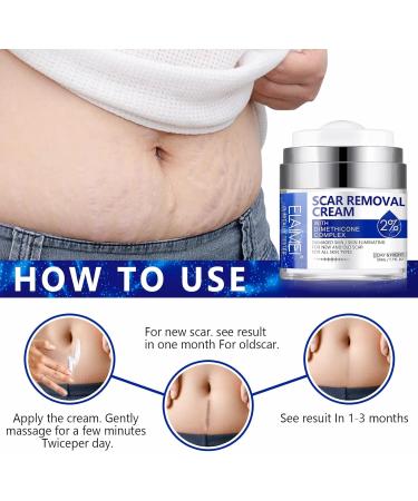 Uocasi Scar Removal Cream Scar Remover Treatment Butter Skin Repair Cream for New and Old Scars Effectively Repairs Facial Skin Cuts Stretch Marks Surgical Scars 50ML - Buy Online on GoSupps.com