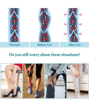 Blahhey XL Footless Compression Stockings 15-20 mmHg Support - Beige X-Large - Buy Online on GoSupps.com