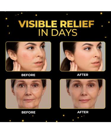 Anume Naturals Goldenseal Ointment Herbal Skin Balm with Golden Seal MCT Oil & Olive Oil for Dry or Irritated Skin 100% Natural Plant-Based Vegan & Cruelty-Free - Buy Online on GoSupps.com