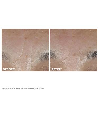 Clarins NEW Total Eye Lift | Anti Aging Eye Cream | Targets Wrinkles Crow's Feet Dark Circles and Puffiness For a Visible Eye Lift in 30 Seconds | REFILLABLE Total Eye Lift Set - Buy Online on GoSupps.com