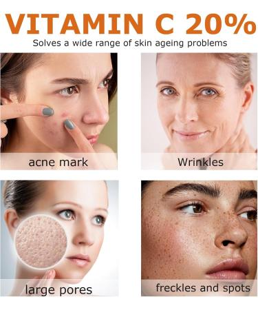 Vitamin C Serum For Face 20% Vitamin C Serum With Hyaluronic Acid For Collagen Boost Anti-Wrinkle Anti-Aging Dark Circle Sun Damage Brighten Hydrate Face Serum - Buy Online on GoSupps.com