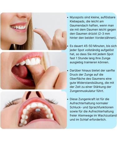 Myospots - Flavorful Tongue Training Tablets (100 pcs) for Better Breathing & Health - Versatile Support for Oral Wellness - Buy Online on GoSupps.com
