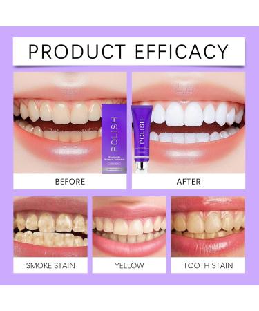 Anti-Badging Toothpaste 153g Gentle Refreshing Deep Clean Removes Dental Stains for Adults | For Women Men Coffee Lovers Morning Evening Daily Travel Home Office - Buy Online on GoSupps.com