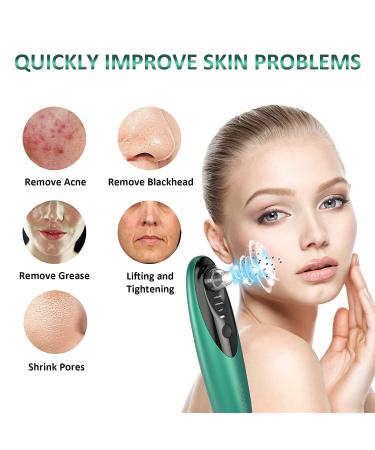 Blackhead Remover Pore Vacuum with Camera - Rechargeable Blackhead Suction Tool for Face and Nose - Skin Acne Pimple Cleaner for Men and Women - Buy Online on GoSupps.com