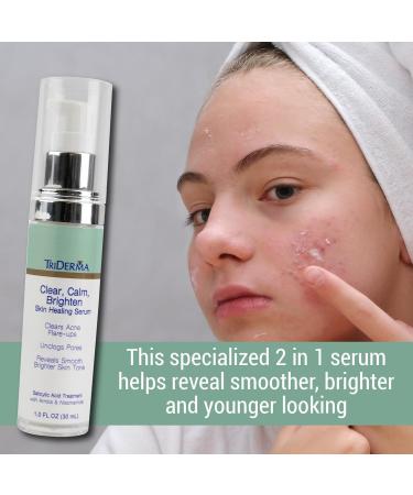 TriDerma Clear Calm & Brighten Serum | 2% Salicylic Acid & Niacinamide for Acne Blemishes & Pore Unclogging - 1 oz - Buy Online on GoSupps.com