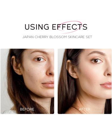Cherry Blossom Skin Care Set for Teen Girls - Deeply Hydrates - Reduces Fine Lines - Includes Cleanser Toner Serum Essence Eye Cream Moisturizer - Buy Online on GoSupps.com