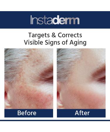 Glycolic Acid 15% Anti-Aging Cream | Exfoliating Facial Moisturizer for Fine Lines Wrinkles & Dark Spots - Buy Online on GoSupps.com