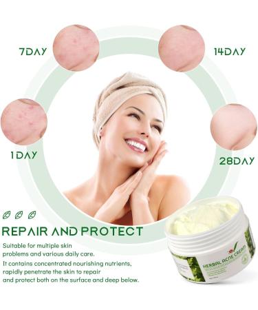 Beslibate herbal acne cream - 1.76 oz - Buy Online on GoSupps.com