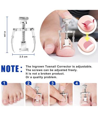 JTIEO 9PACK Ingrown Toenail Clippers & Treatment Kit - Professional Stainless Steel Tool Set for Thick Nails - Style-B 9Pcs-Black - Buy Online on GoSupps.com