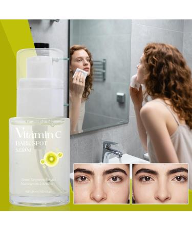  WJnflQN Facial Lightening Liquid Gentle Facial Care Solution 30ml | Moisturizing and Lightening Lotion for Women and Girls - Buy Online on GoSupps.com