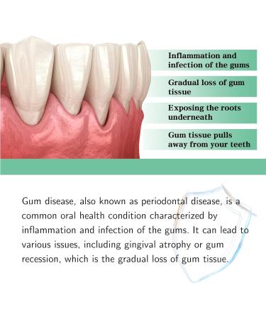 Gum Regrowth Gouttes soulagement des gencives restauration des gencives r paration de la perte des gencives gouttes de prog niture des gencives gouttes naturelles de soin buccal - Buy Online on GoSupps.com