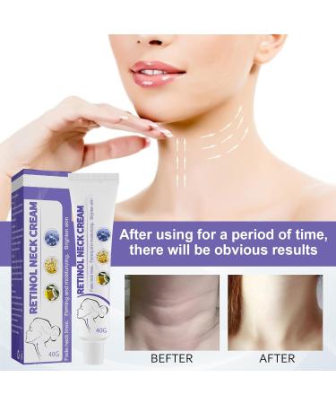 Neck Tightening Cream Duo - Firming & Lifting Sagging Skin, Reduce Wrinkles & Fine Lines - 40g x 2 - Buy Online on GoSupps.com