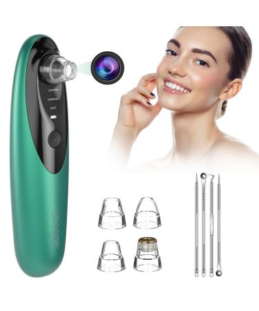 Blackhead Remover Pore Vacuum with Camera – Visual Blackhead Vacume Remover Electric Rechargeable Face Nose Pimple Skin Acne Pore Cleaner Sucker Extractor Black Head Suction Tool for Women Men Green