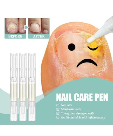3PCS Nail Care Pen - Fungus Treatment & Nail Health for Perfect Fingernails & Toenails - International Shipping - Buy Online on GoSupps.com