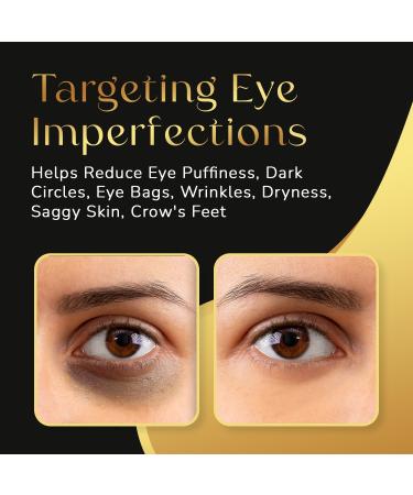 RBW 24k Gold Under Eye Patches - Reduce Dark Circles Puffiness & Wrinkles - Hydrating Hyaluronate Eye Masks - 20 Pairs for Rejuvenating Treatment for Men & Women - Buy Online on GoSupps.com