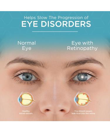 Viszen-M Eye Health Vitamins Complete Vision Formula with Lutein Zeaxanthin Quercetin and Bilberry 60 Capsules - Elan Healthcare - Buy Online on GoSupps.com