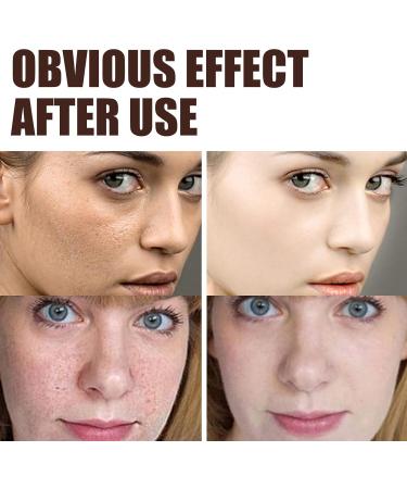 Anti-Wrinkle Face & Neck Retinol Cream with Hyaluronic Acid - Premium Anti-Aging Face Moisturizer - Anti Aging Firming Facial Cream to Reduce Wrinkles Dark Spots Fine Lines Sun Damage - Buy Online on GoSupps.com