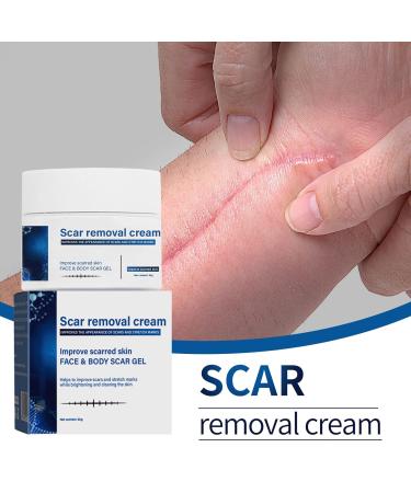 Soothing Scar Removal Cream for Body, Stretch Marks & Tan - Light Blue (One Size) - Buy Online on GoSupps.com