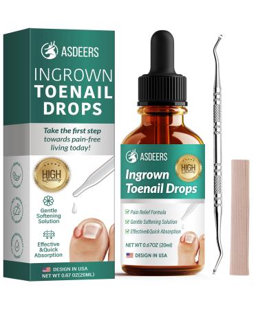 Ingrown Toenail Treatment: Ingrown Toenail Removal Kit - Nail Toe Reliever and Softener Tools for Men Women - Corrector Drops Easy to Use at Home