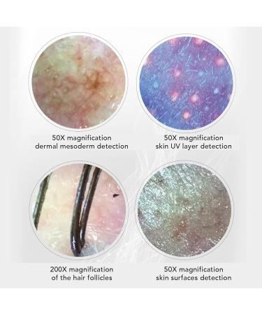 Hair Follicle Skin Detector 50X 200X Magnification 3 Light Modes High Definition Clear Imaging Skin Diagnosis Hair Analyzer for Hair Care Center (US Plug) - Buy Online on GoSupps.com
