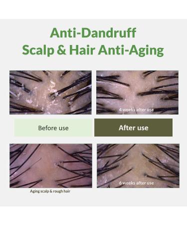 CKD Amino Biotin Anti-Dandruff Shampoo 16.9 fl.oz | Hair Loss Relief Biotin & Protein for Hair Growth & Volume | Anti-Aging Formula - Buy Online on GoSupps.com