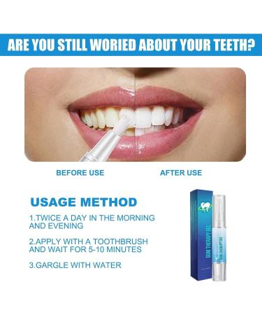 Teeth Whitening Pen Set - Effective Rotary Tooth Stain Remover Gentle Formula for Sensitive Teeth 3PC - Achieve a Radiant Smile! - Buy Online on GoSupps.com