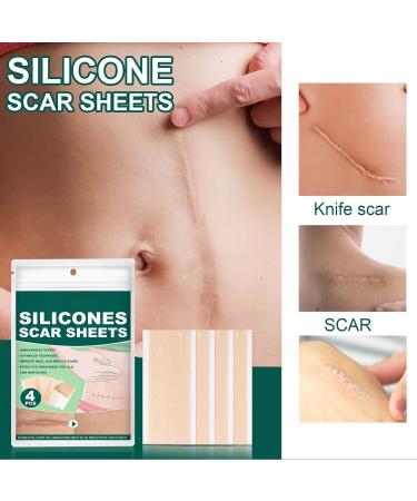 Skin Scar Concealing Tape - Ultra Thin & Breathable Covering Sticker for Beauty Care - 4pcs - Buy Online on GoSupps.com