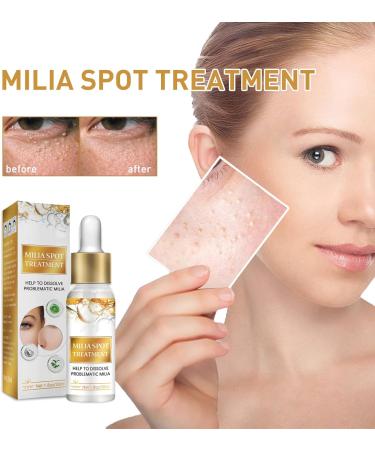 Milia Removal Face Serums Milia Spot Remover Milia Remover Milia Spot Serum for Face Milia Serum for Face Milia Spot Serum Helps to Ruduce Milia Reduces Bags Saggy Skin & Puffy Eyes 30ML - Buy Online on GoSupps.com