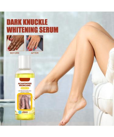  Sloane Exfoliating Oil Old Yellow Exfoliating Oil for 110ml Exfoliating Oil for Skin Against Dark Spots on Body Natural Exfoliating Oil Yellow for Lightening Spots Improves Skin - Buy Online on GoSupps.com