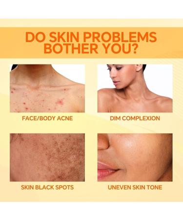 Kojic Acid Soap Papaya Soap Mens Soap Bar Olive Oil Soap Natural Soap Olive Oil Soap Bar for Face And Body natural soap for Fades Age Spots Freckles Reduce Acne Dark Spot Remover for Face - Buy Online on GoSupps.com