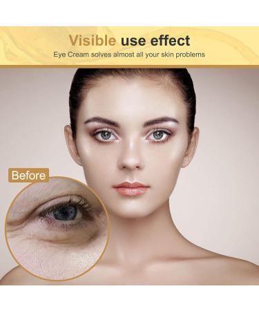 Anti-Aging Eye Cream for Dark Circles & Puffiness - Effective Retinol Treatment for Bags Under Eyes - Buy Online on GoSupps.com