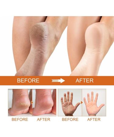 Spray peeling pour les pieds limination des peaux mortes hydratation et claircissement de la peau lissage des pieds secs et fissur s multi-usage pour les mains et les articulations (1PCS) - Buy Online on GoSupps.com