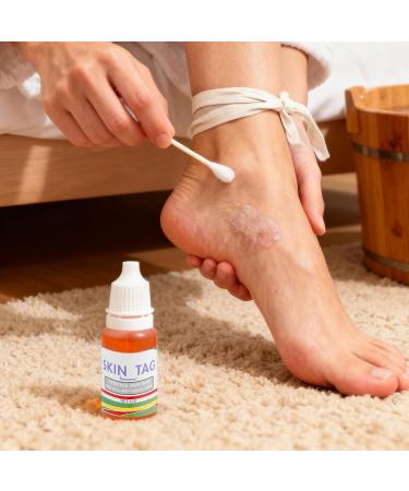 Mole Remover for the Body | 25g Blemish Corrector Beauty Care | Body Mole Removal For Women At Home While Traveling Daily Routine Care - Buy Online on GoSupps.com