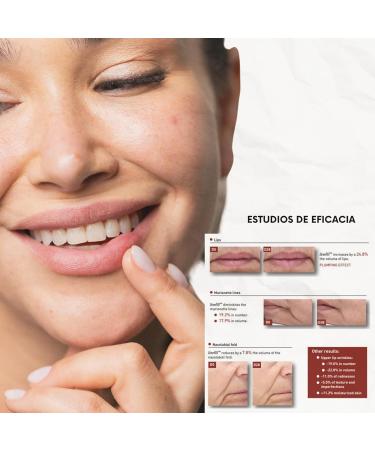  AOKLABS AOKlabs - African Gold Lip Unrefined Shea Butter - Special lip and nasolabial area care I 50 ml. - Buy Online on GoSupps.com