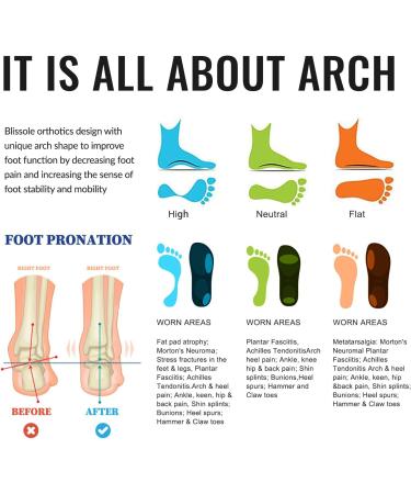 Buy Orthotic Insoles for Plantar Fasciitis | Heel Pain Relief & Arch Support | Shock Absorption for Flat Feet - XL Blue - Buy Online on GoSupps.com