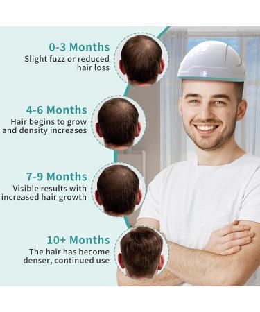 LaseLocks Laser Helmet for Hair Loss 650nm Red Light Laser Stimulates Hair Follicle Growth FDA Cleared Hair Growth Cap Treatments Restore Hair Thickness Alopecia Rechargeable - Buy Online on GoSupps.com