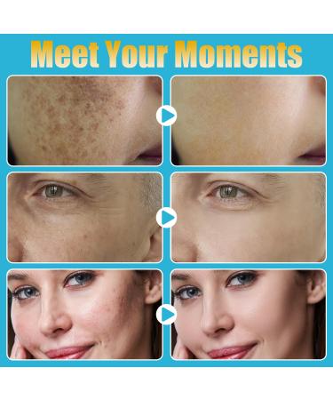 Home Use Derma Roller Pen Skin Care Beauty Kit Tool for Face Hair Beard - Buy Online on GoSupps.com