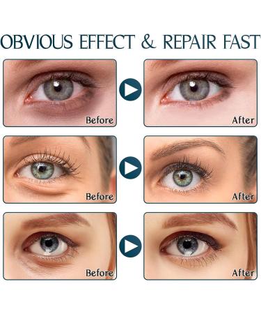 Collagen Under Eye Patches - 30 Pair Masks for Puffy Eyes, Dark Circles, and Wrinkles - Eye Care Skincare for Men and Women - Buy Online on GoSupps.com