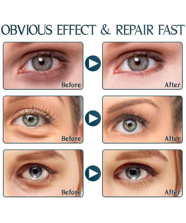 60PCS Aloe Vera & Collagen Under Eye Patches for Dark Circles, Puffiness & Wrinkles - Buy Online on GoSupps.com