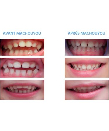 Machouyou Teething Ring - Buy Online on GoSupps.com